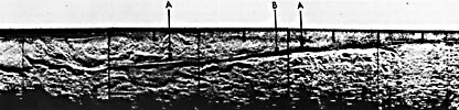 Figure 12.15b