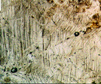 Color photomicrograph of decorated PDFs from the Manson structure.